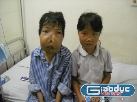 Hai anh em Nguyên và Hằng Hai anh em Nguyên và Hằng