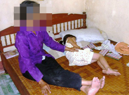 Cháu Na hay bị hoang loạn, thường khóc mỗi khi không có người nhà bên cạnh. Cháu Na hay bị hoang loạn, thường khóc mỗi khi không có người nhà bên cạnh.