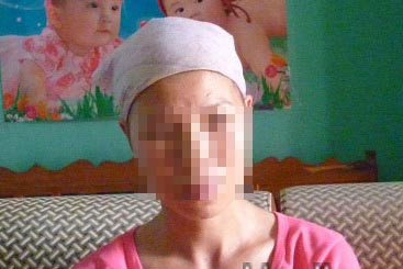 Muốn con gái lấy chồng, tiêm thuốc chữa hói thối cả thịt ảnh 1 Muốn con gái lấy chồng, tiêm thuốc chữa hói thối cả thịt ảnh 1