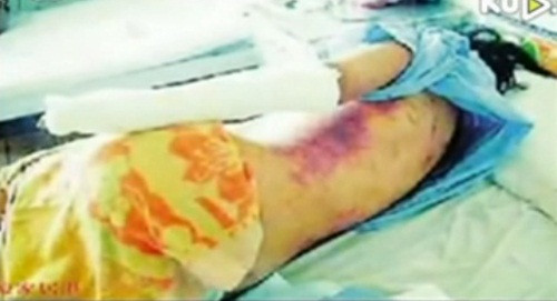 "Quần khóa trinh tiết" và những vụ việc khiến dư luận rùng mình ảnh 3 "Quần khóa trinh tiết" và những vụ việc khiến dư luận rùng mình ảnh 3