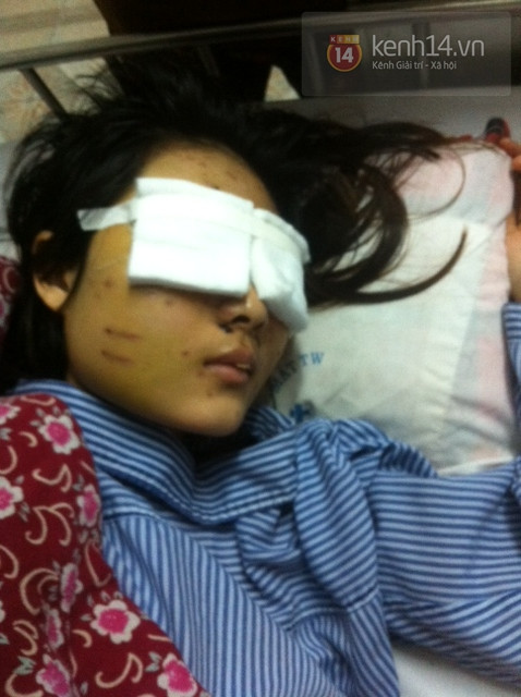 Gương mặt bị vết thương do đầu đạn súng hoa cải bắn, còn đôi mắt đã bị phá hủy hoàn toàn. Không có khả năng phục hồi cũng như thay ghép Mỗi khi tâm trạng khá hơn một chút, Chinh lại nhắc đến việc phải bỏ học giữa chừng, không biết đến lúc nào mới có thể quay trở lại trường học... Chinh vẫn chưa biết rằng đôi mắt của mình sẽ vĩnh viễn không bao giờ nhìn thấy được nữa Những ngày này, gia đình ở bên cạnh chăm sóc... Nhưng với đôi mắt không còn nhìn thấy ánh sáng, di chứng đầu đạn nằm trong não... tương lai của cô gái mới chỉ 19 tuổi này sẽ ra sao? Gương mặt bị vết thương do đầu đạn súng hoa cải bắn, còn đôi mắt đã bị phá hủy hoàn toàn. Không có khả năng phục hồi cũng như thay ghép Mỗi khi tâm trạng khá hơn một chút, Chinh lại nhắc đến việc phải bỏ học giữa chừng, không biết đến lúc nào mới có thể quay trở lại trường học... Chinh vẫn chưa biết rằng đôi mắt của mình sẽ vĩnh viễn không bao giờ nhìn thấy được nữa Những ngày này, gia đình ở bên cạnh chăm sóc... Nhưng với đôi mắt không còn nhìn thấy ánh sáng, di chứng đầu đạn nằm trong não... tương lai của cô gái mới chỉ 19 tuổi này sẽ ra sao?