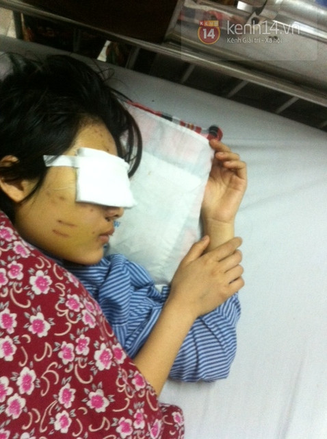 Ước mơ dở dang của 'cô giáo mầm non' bị người yêu bắn nát mặt ảnh 3 Ước mơ dở dang của 'cô giáo mầm non' bị người yêu bắn nát mặt ảnh 3