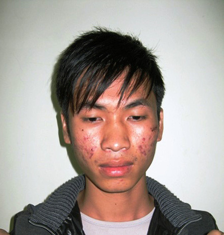 Chân dung đối tượng "Kẹo mút chơi bời" Đinh Mạnh Linh. Chân dung đối tượng "Kẹo mút chơi bời" Đinh Mạnh Linh.