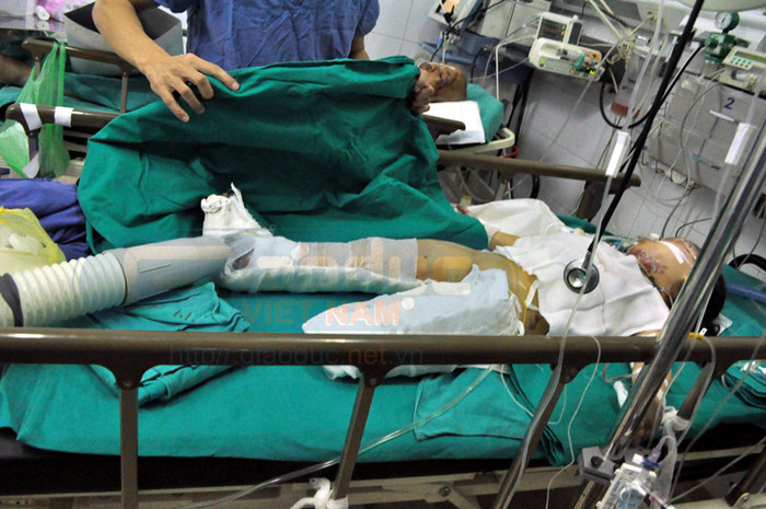 Trong khi đó, hoàn cảnh kinh tế nhà cháu cũng rất khó khăn. Trước khi xảy ra tai nạn, bố mẹ cháu là công nhân nên cuộc sống hết sức eo hẹp. Khi tai nạn xảy ra, tài sản lớn nhất trong nhà là chiếc xe máy Dream (Việt) đã nổ tung...