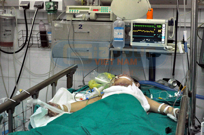 Hiện, cháu Vân đang phải nằm trong phòng hồi sức và phải thở bằng máy. Mặt, ngực và tay cháu bị phù nặng...