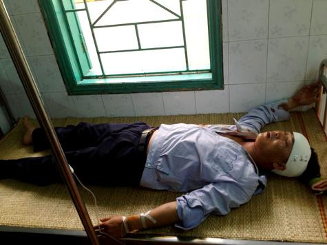 Hiện, anh Toàn vẫn đang phải điều trị tại bệnh viện Hà Đông Hiện, anh Toàn vẫn đang phải điều trị tại bệnh viện Hà Đông