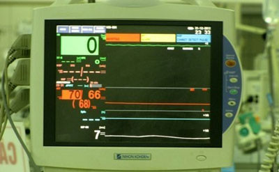 Khi vào viện, tim của bệnh nhân Thảo gần như đã ngừng hoạt động. Trạng thái này đã diễn ra liên tục 12 tiếng trước khi bệnh nhân được khởi động hệ thống tim phổi ngoài cơ thể tại giường để cấp cứu (Ảnh do bác sỹ cung cấp) Khi vào viện, tim của bệnh nhân Thảo gần như đã ngừng hoạt động. Trạng thái này đã diễn ra liên tục 12 tiếng trước khi bệnh nhân được khởi động hệ thống tim phổi ngoài cơ thể tại giường để cấp cứu (Ảnh do bác sỹ cung cấp)