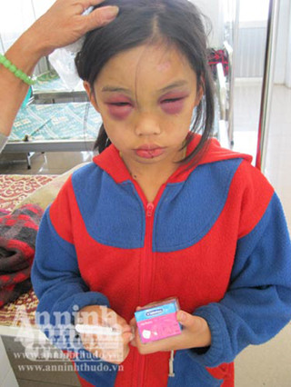 Cháu Phi đã bớt sợ hãi khi tiếp xúc với người lạ Cháu Phi đã bớt sợ hãi khi tiếp xúc với người lạ