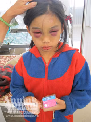 Cháu Phi đã bớt sợ hãi khi tiếp xúc với người lạ