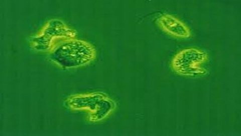 Amip Naegleria Fowler gây tử vong cho bệnh nhi 6 tuổi tại TP HCM (Ảnh do bác sỹ cung cấp)