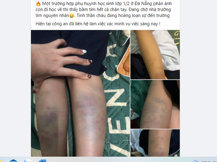 Hình ảnh được lan truyền trên mạng xã hội trưa ngày 6/10. Ảnh chụp màn hình. Hình ảnh được lan truyền trên mạng xã hội trưa ngày 6/10. Ảnh chụp màn hình.