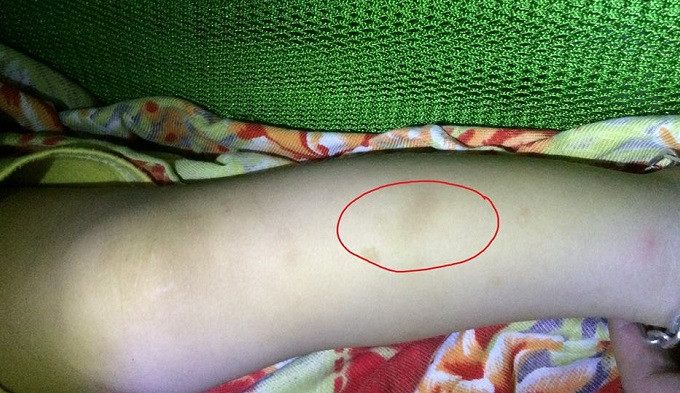 Cô giáo mầm non trói tay chân, nhét giẻ vào mồm trẻ ảnh 4