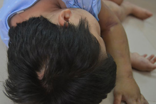 Bé 10 tuổi bị cha đẻ hành hạ: Mẹ đi tù, bố dùng búa đinh 'dạy' con ảnh 2 Mẹ đi tù, bố dùng búa đinh "dạy" con, Tin tức trong ngày, bao hanh tre em, danh con, danh dap tre em, nguoc dai tre em, tai nan, chan thuong so nao, chan dong tam than, toi pham, bao, tin nhanh, tin hot, tin tuc