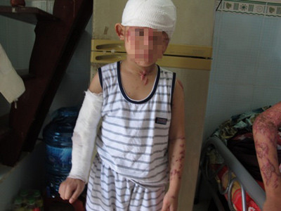 Kẻ tạt axit cả gia đình đi chữa bệnh tâm thần, An ninh Xã hội, tat axit, tam than, tat axit ca nha, mu hai mat, bao, bao cong an, bao an ninh