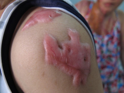 Kẻ tạt axit cả gia đình đi chữa bệnh tâm thần, An ninh Xã hội, tat axit, tam than, tat axit ca nha, mu hai mat, bao, bao cong an, bao an ninh