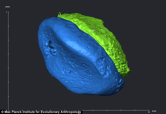 Hình ảnh xương ngón tay đuwọc mô phỏng trên máy tinh