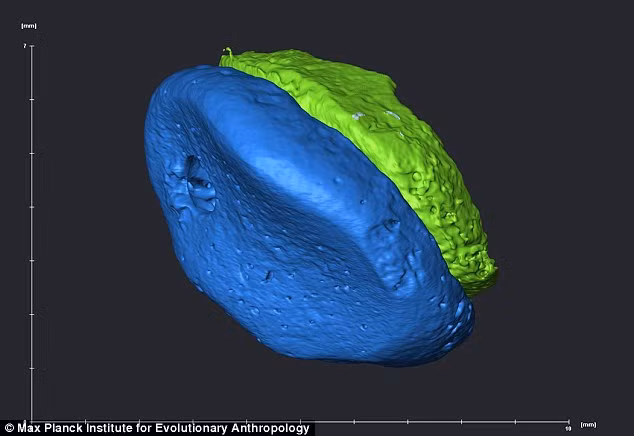 Hình ảnh xương ngón tay đuwọc mô phỏng trên máy tinh