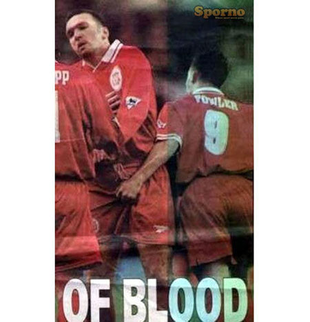 Đố ai trụ được khi nhận đòn hiểm này của Robbie Fowler (cựu tiền đạo CLB Liverpool). Đố ai trụ được khi nhận đòn hiểm này của Robbie Fowler (cựu tiền đạo CLB Liverpool).