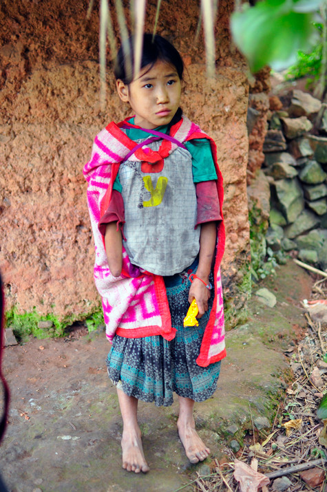 Bé Sùng Thị May, học sinh lớp 4, mất bàn tay phải vì thái cỏ bò giúp bố mẹ (Ảnh Trần Lân) Bé Sùng Thị May, học sinh lớp 4, mất bàn tay phải vì thái cỏ bò giúp bố mẹ (Ảnh Trần Lân)