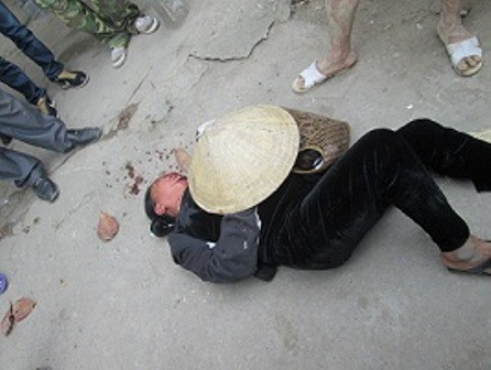 Bà Bình mặt đầy máu sau khi bị đánh Bà Bình mặt đầy máu sau khi bị đánh