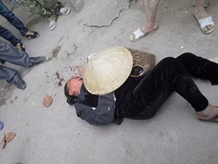 Bà Bình mặt đầy máu sau khi bị đánh