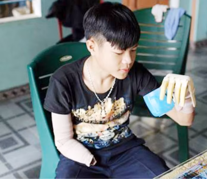 Hiếu đã có thể tự pha nước uống với cánh tay robot. Ảnh: AN