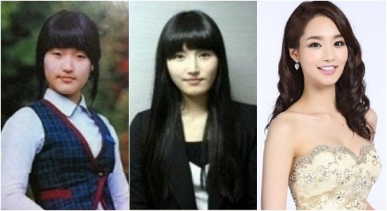 Rõ ràng dao kéo đã can thiệp để nâng mũi, cắt mí mắt, gọt cằm, giúp Kim Yu Mi trở nên xinh đẹp hơn. Rõ ràng dao kéo đã can thiệp để nâng mũi, cắt mí mắt, gọt cằm, giúp Kim Yu Mi trở nên xinh đẹp hơn.