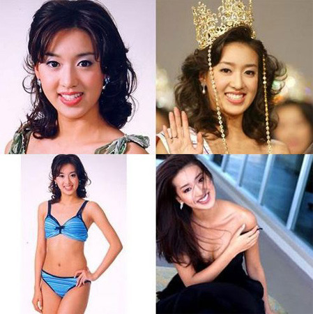 Hoa hậu Hàn Quốc 2003 Choi Yoon Young đã nhờ dao kéo để khuôn mặt trở nên thanh thoát hơn. Hoa hậu Hàn Quốc 2003 Choi Yoon Young đã nhờ dao kéo để khuôn mặt trở nên thanh thoát hơn.