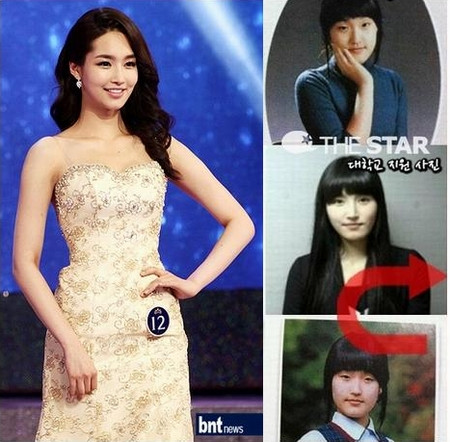 Rõ ràng dao kéo đã can thiệp để nâng mũi, cắt mí mắt, gọt cằm, giúp Kim Yu Mi trở nên xinh đẹp hơn. Rõ ràng dao kéo đã can thiệp để nâng mũi, cắt mí mắt, gọt cằm, giúp Kim Yu Mi trở nên xinh đẹp hơn.