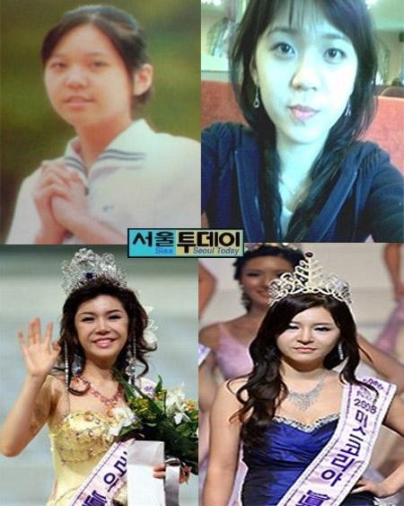 Hoa hậu Hàn Quốc 2008 thay đổi chóng mặt nhờ sự can thiệp của dao kéo. Hoa hậu Hàn Quốc 2008 thay đổi chóng mặt nhờ sự can thiệp của dao kéo.