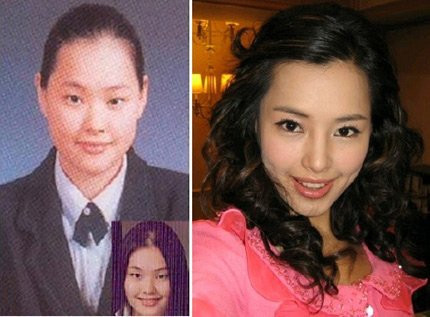 Lee Honey nhờ phẫu thuật thẩm mỹ mà trở thành một hoa hậu xinh đẹp và rất thành công. Lee Honey nhờ phẫu thuật thẩm mỹ mà trở thành một hoa hậu xinh đẹp và rất thành công.