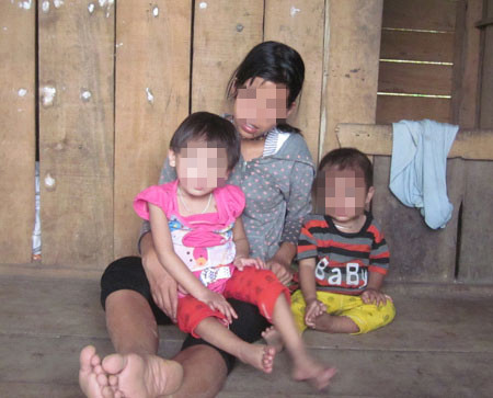 Cháu H.T.H. (trái) bị dị tật bẩm sinh là kết quả của một cuộc hôn nhân cận huyết Cháu H.T.H. (trái) bị dị tật bẩm sinh là kết quả của một cuộc hôn nhân cận huyết