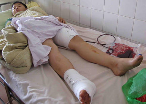 Em Hiếu bị thương, đang điều trị tại bệnh viện. Ảnh: Thanh Luận.