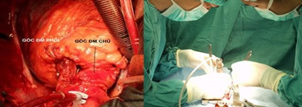 Những công nghệ chữa bệnh hiện đại, đặc biệt ở bệnh viện Bạch Mai ảnh 2 Những công nghệ chữa bệnh hiện đại, đặc biệt ở bệnh viện Bạch Mai ảnh 2