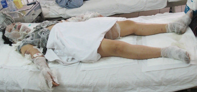 Chị Luyến đang được cấp cứu. Anh: Phạm Duẩn. Chị Luyến đang được cấp cứu. Anh: Phạm Duẩn.