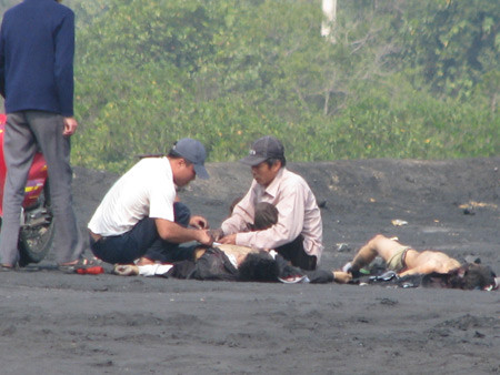 Nạn nhân của 1 vụ nổ súng hoa cải ở Quảng Ninh. Nạn nhân của 1 vụ nổ súng hoa cải ở Quảng Ninh.