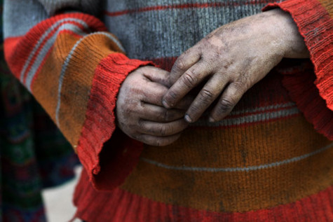 Ai không xót xa khi nhìn bàn tay của em nhỏ Pả Vi này?! (Ảnh Nam Phong) Ai không xót xa khi nhìn bàn tay của em nhỏ Pả Vi này?! (Ảnh Nam Phong)