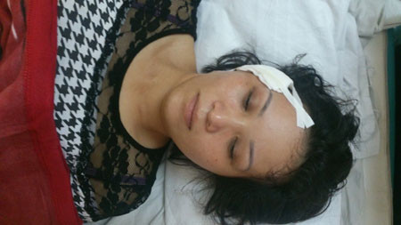 Viên đạn cách thái dương 1cm Viên đạn cách thái dương 1cm