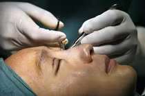 Con sốt thẩm mỹ 'càn quét' thiếu nữ đôi mươi