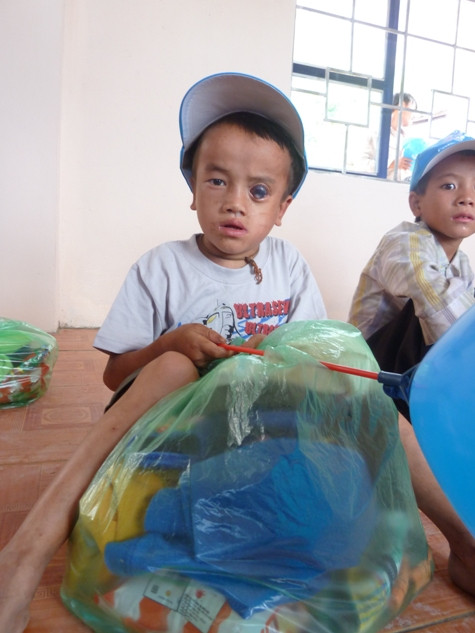 Cậu bé Giàng A Trống Khua (6 tuổi) mồ côi cha mẹ, sống với bà ngoài. Mắt trái của cậu ngày càng mờ đi, lồi to hơn (ảnh Đình Phong). Cậu bé Giàng A Trống Khua (6 tuổi) mồ côi cha mẹ, sống với bà ngoài. Mắt trái của cậu ngày càng mờ đi, lồi to hơn (ảnh Đình Phong).