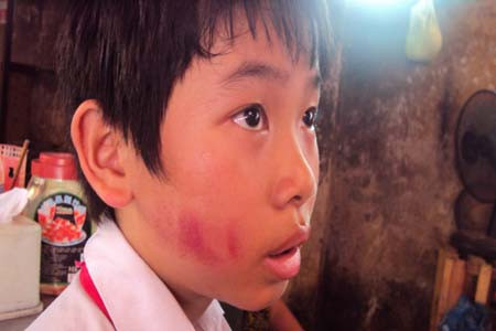 Một học sinh bị cô Hằng vụt. Một học sinh bị cô Hằng vụt.