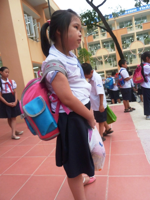 Cách đây hơn một năm, một học sinh ở TP HCM đã bị gãy xương đòn trái, cột sống bị vẹo, gù nhẹ do đeo cặp nặng đi bộ nhiều ngày liền. CHÙM ẢNH: HỌC SINH TIỂU HỌC XÀI ĐIỆN THOẠI ĐẮT TIỀN TEEN SÀI THÀNH GIAN NAN "VƯỢT SÔNG" ĐẾN TRƯỜNG CHÙM ẢNH: NỮ SINH SƯ PHẠM TỎA SÁNG KHOE DÁNG NGỌC