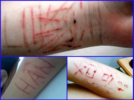 Tự rạch tay hành xác là một biểu hiện của lối sống và tâm lý không bình thường của một bộ phận giới trẻ hiện nay. Tự rạch tay hành xác là một biểu hiện của lối sống và tâm lý không bình thường của một bộ phận giới trẻ hiện nay.