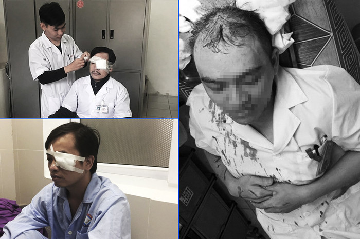 Năm 2017, Nhiều vụ hành hung, tấn công thầy thuốc khi làm nhiệm vụ khiến dư luận bức xúc (Ảnh: VNN) Năm 2017, Nhiều vụ hành hung, tấn công thầy thuốc khi làm nhiệm vụ khiến dư luận bức xúc (Ảnh: VNN)