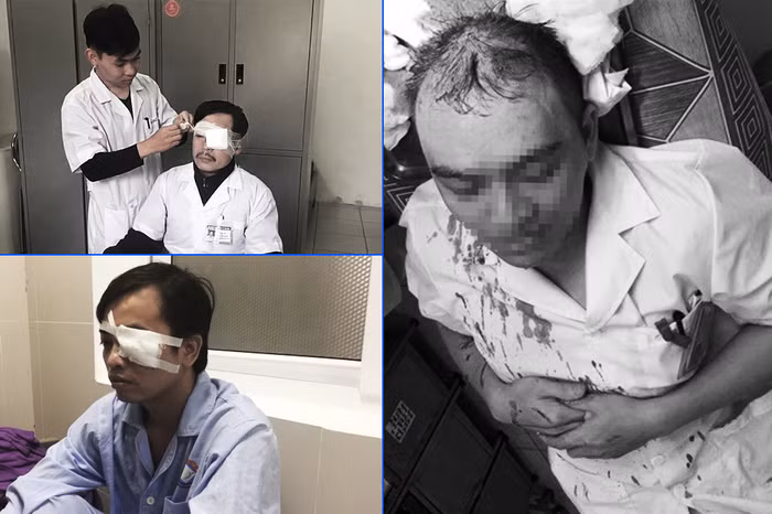 Năm 2017, Nhiều vụ hành hung, tấn công thầy thuốc khi làm nhiệm vụ khiến dư luận bức xúc (Ảnh: VNN) Năm 2017, Nhiều vụ hành hung, tấn công thầy thuốc khi làm nhiệm vụ khiến dư luận bức xúc (Ảnh: VNN)