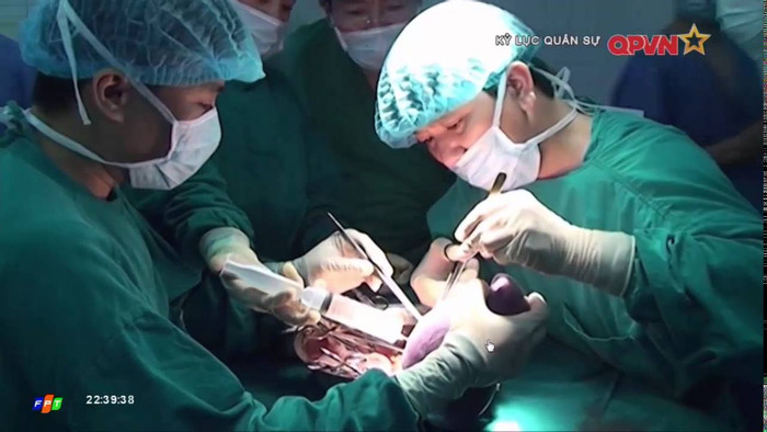 Bệnh viện Quân y 103, Học viện Quân y đã phối hợp với các chuyên gia Nhật Bản thực hiện thành công ca ghép phổi đầu tiên trên người tại Việt Nam. Bệnh nhân được ghép phổi là cháu bé 6 tuổi. (Ảnh: Truyền hình quân đội) Bệnh viện Quân y 103, Học viện Quân y đã phối hợp với các chuyên gia Nhật Bản thực hiện thành công ca ghép phổi đầu tiên trên người tại Việt Nam. Bệnh nhân được ghép phổi là cháu bé 6 tuổi. (Ảnh: Truyền hình quân đội)