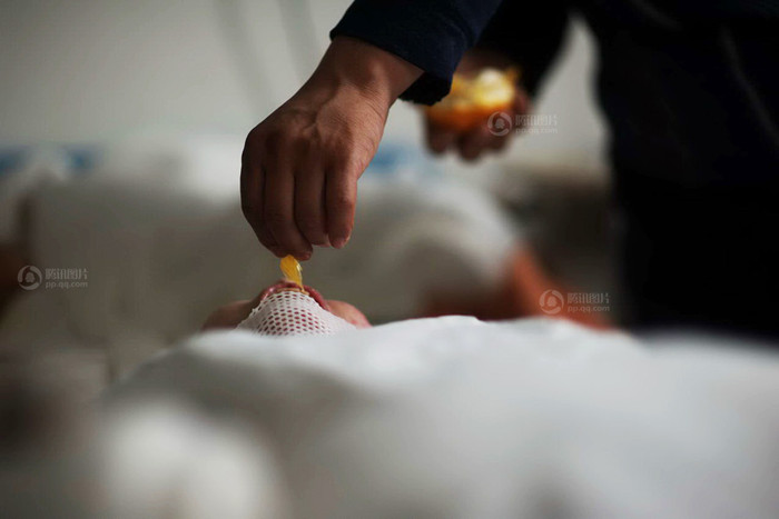 Ông Hữu bóc từng múi cam xé nhỏ cho con ăn, đứa con bé bỏng tội nghiệp giờ lại như đứa trẻ. Ông Hữu bóc từng múi cam xé nhỏ cho con ăn, đứa con bé bỏng tội nghiệp giờ lại như đứa trẻ.
