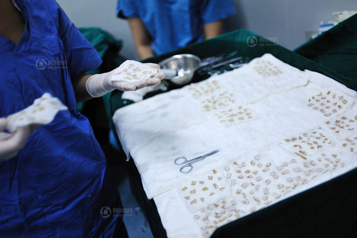 Người cha mang cho Xuân sự sống, giờ đây tuổi đã xế chiều một lần nữa "cắt thịt cứu con". Người cha mang cho Xuân sự sống, giờ đây tuổi đã xế chiều một lần nữa "cắt thịt cứu con".