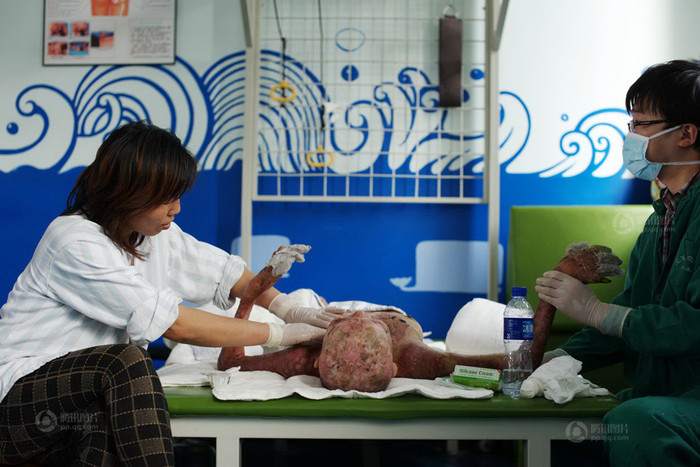 Và bây giờ, cô nằm đó trên giường bệnh, may mắn giữ được tính mạng, nhưng cả một chuỗi ngày dài trước mặt, rồi Xuân và gia đình sẽ sống ra sao? Và bây giờ, cô nằm đó trên giường bệnh, may mắn giữ được tính mạng, nhưng cả một chuỗi ngày dài trước mặt, rồi Xuân và gia đình sẽ sống ra sao?