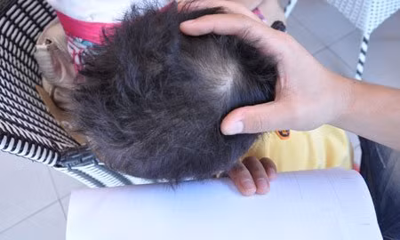 Theo gia đình, bé T.S mấy ngày qua nhất quyết không muốn đến trường vì “sợ bị cô giáo đánh”.